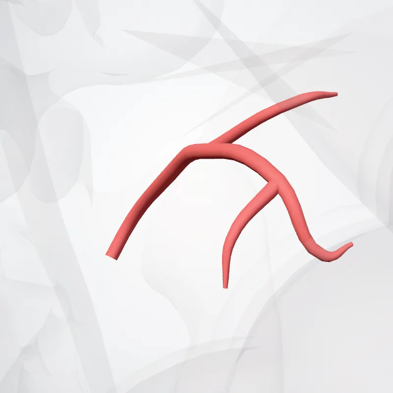 Ramus lumbalis arteriae iliolumbalis (Lumbar branch of iliolumbar artery) hervorgehoben in einem 3D-Modell des menschlichen Körpers