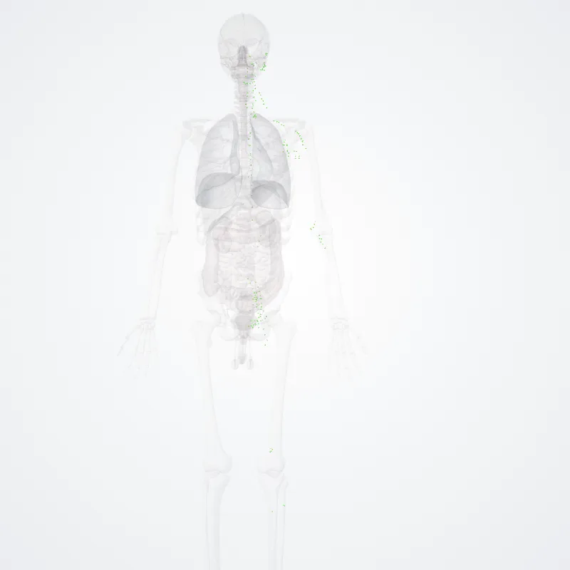 Lymph nodes (Nodi lymphoidei) highlighted in a 3D model of the human body
