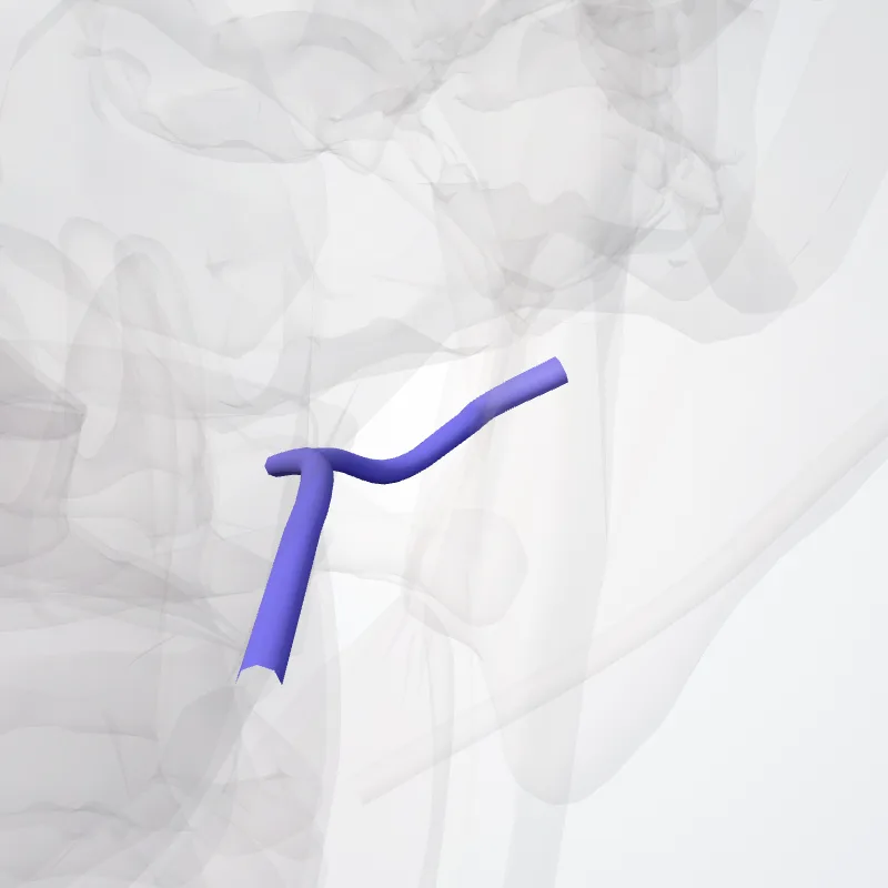 Venae maxillares (Maxillary veins) hervorgehoben in einem 3D-Modell des menschlichen Körpers