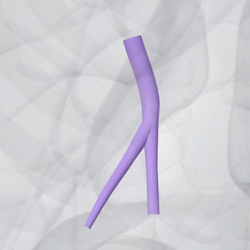 Medial basal segmental artery of left lung (Arteria segmentalis basalis medialis pulmonis sinistri) highlighted in a 3D model of the human body