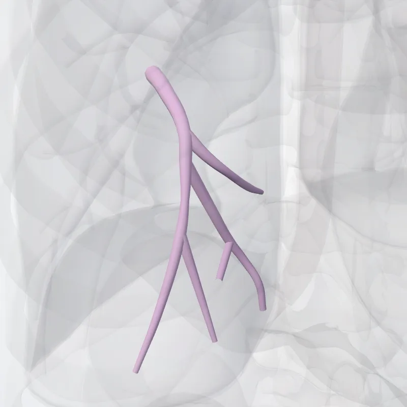 Bronchus segmentalis basalis med. pulmonis sinistri (BVII) (Medial basal segmental bronchus of left lung (BVII)) hervorgehoben in einem 3D-Modell des menschlichen Körpers