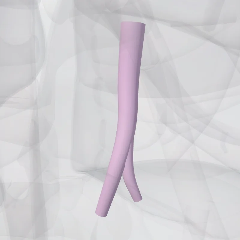 Bronchus segmentalis basalis med. pulmonis dextri (BVII) (Medial basal segmental bronchus of right lung (BVII)) hervorgehoben in einem 3D-Modell des menschlichen Körpers