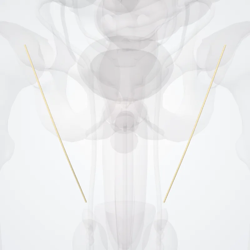 Medial crural cutaneous branches of saphenous nerve (Rami cutanei mediales cruris nervi sapheni) highlighted in a 3D model of the human body