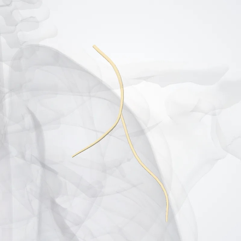 Nervus pectoralis medialis (Medial pectoral nerve) hervorgehoben in einem 3D-Modell des menschlichen Körpers