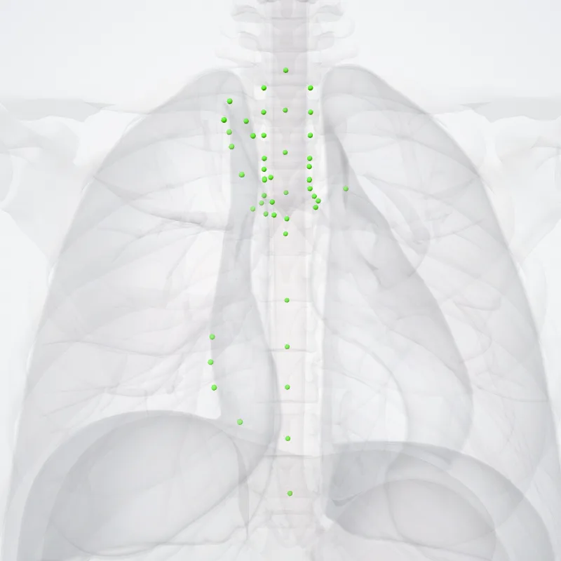 Nodi lymphoidei mediastinaies (Mediastinal lymph nodes) hervorgehoben in einem 3D-Modell des menschlichen Körpers
