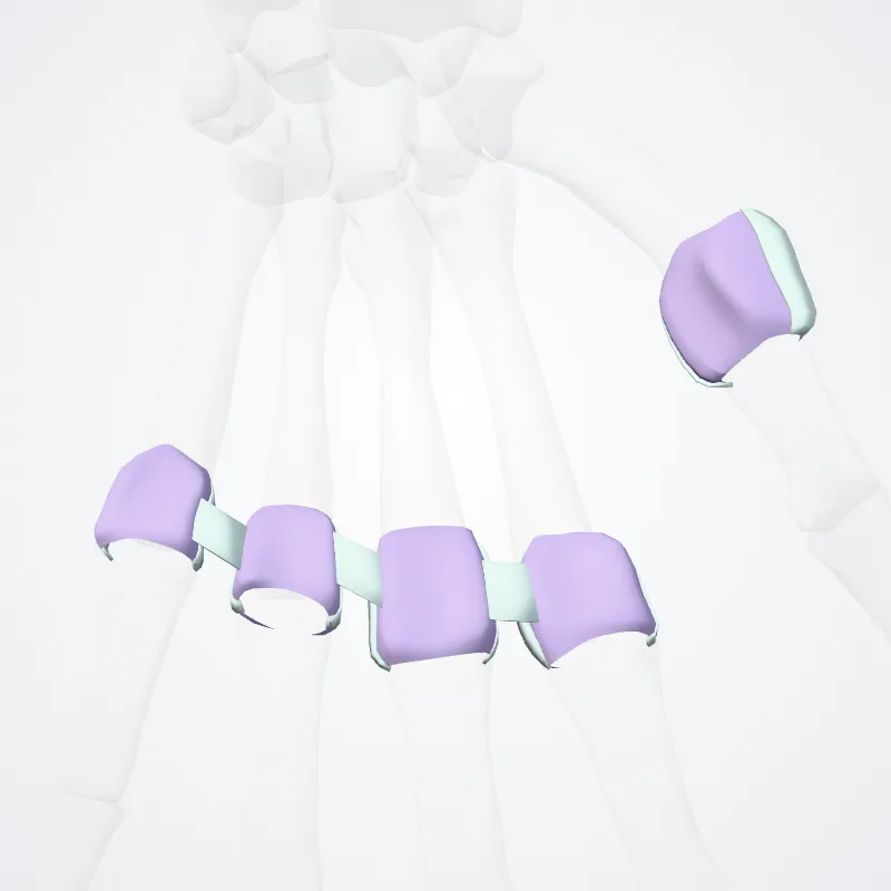 Articulationes metacarpophalangeae (Metacarpophalangeal joints) hervorgehoben in einem 3D-Modell des menschlichen Körpers