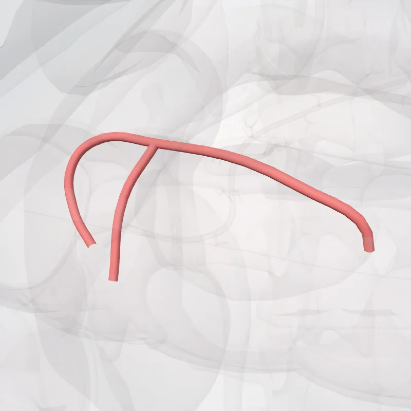 Arteria colica media (Middle colic artery) hervorgehoben in einem 3D-Modell des menschlichen Körpers