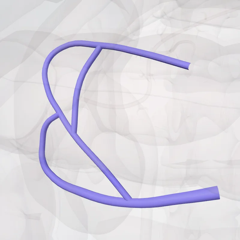 Middle colic vein (Vena colica media) highlighted in a 3D model of the human body