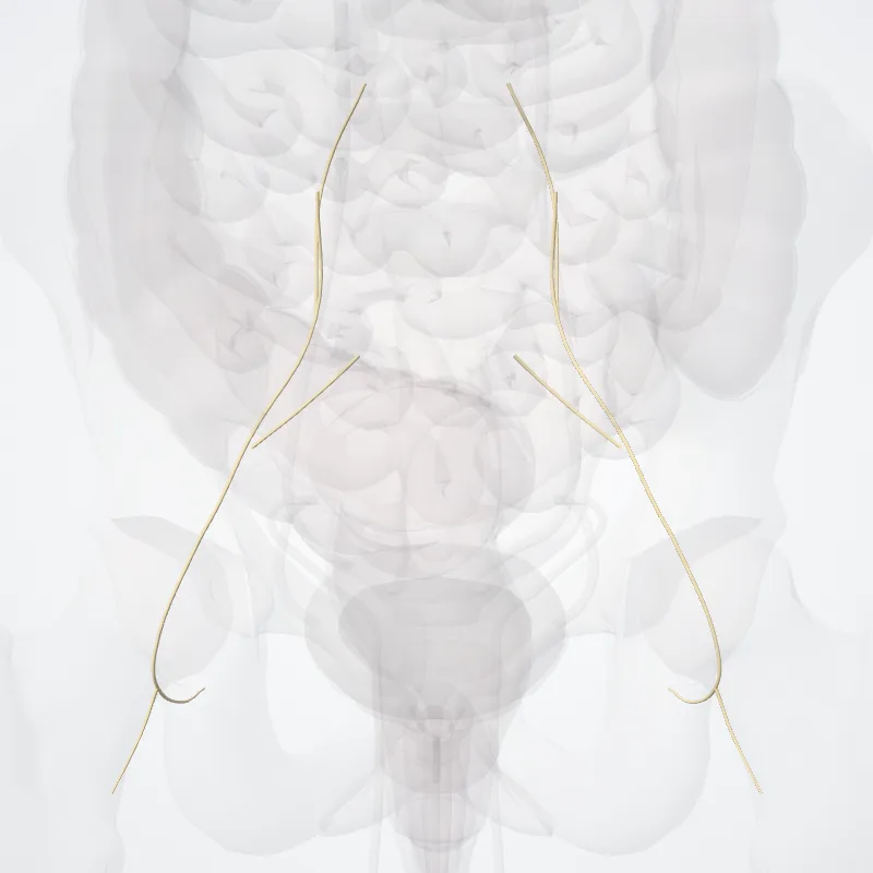 Nervus musculi quadrati femoris (Nerve to quadratus femoris muscle) hervorgehoben in einem 3D-Modell des menschlichen Körpers
