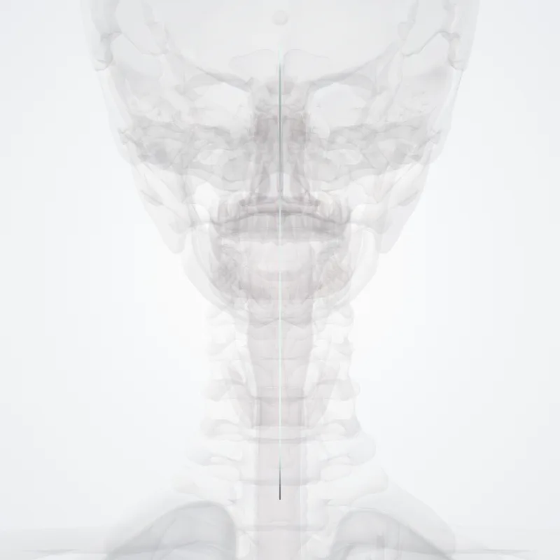 Nuchal ligament (Ligamentum nuchae) highlighted in a 3D model of the human body