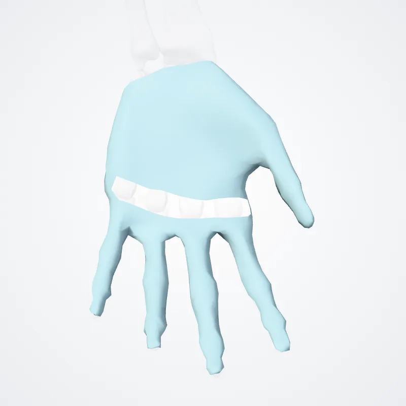Aponeurosis palmaris (Palmar aponeurosis) hervorgehoben in einem 3D-Modell des menschlichen Körpers
