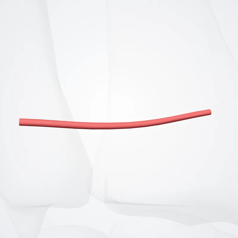 Palmar carpal branch of radial artery (Ramus carpeus palmaris arteriae) highlighted in a 3D model of the human body