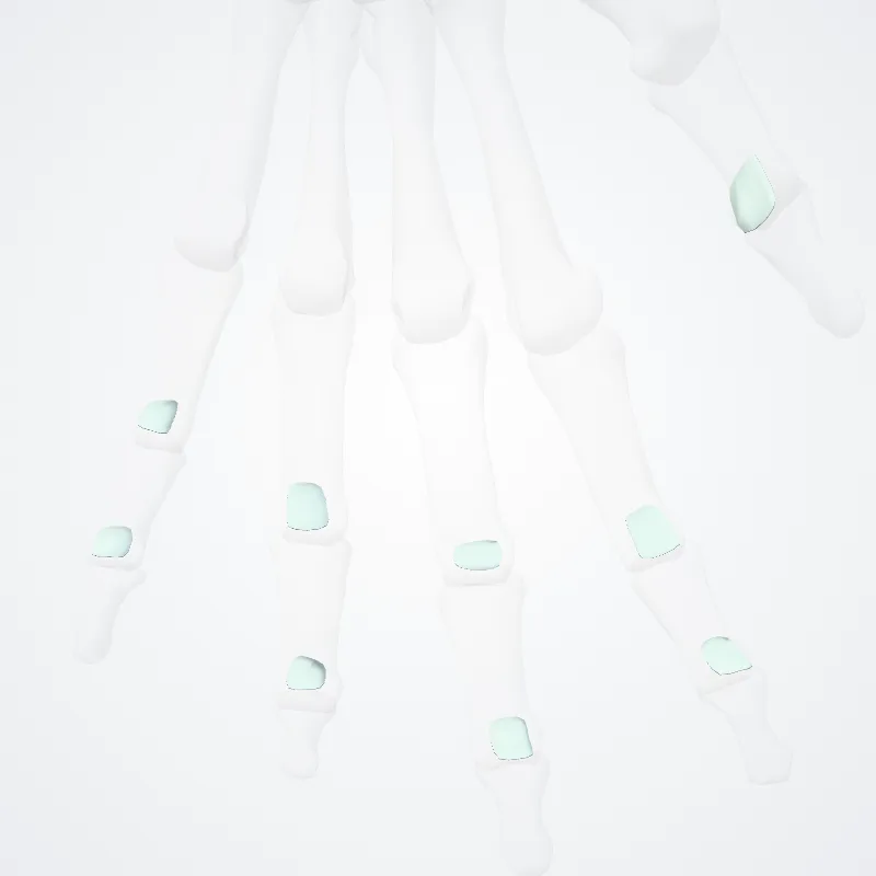 Ligamenta interphalangea palmaria (Palmar interphalangeal ligaments) hervorgehoben in einem 3D-Modell des menschlichen Körpers