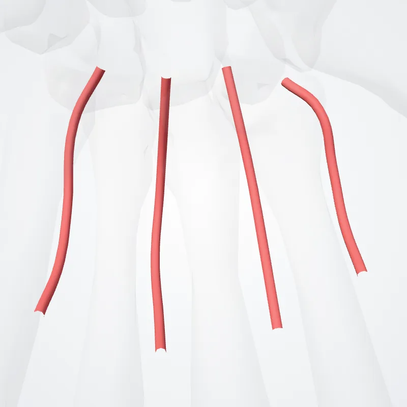 Arteriae metacarpeae palmares (Palmar metacarpal arteries) hervorgehoben in einem 3D-Modell des menschlichen Körpers