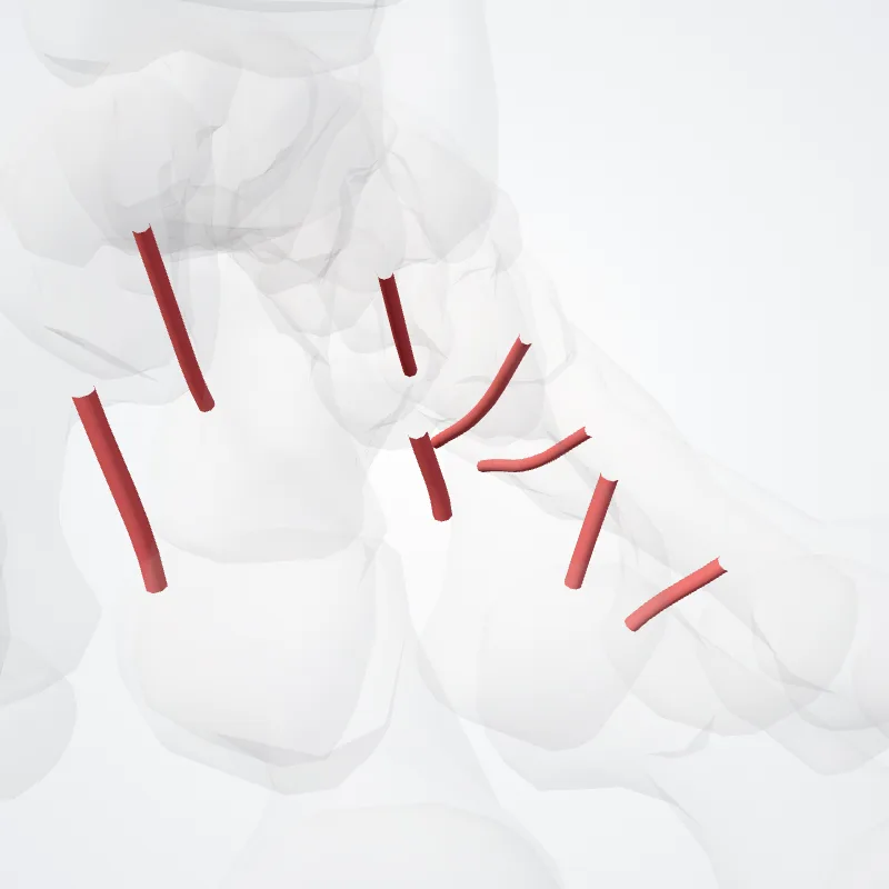 Rami perforantes arteriarum metatarsearum plantarium (Perforating branches of plantar metatarsal arteries) hervorgehoben in einem 3D-Modell des menschlichen Körpers