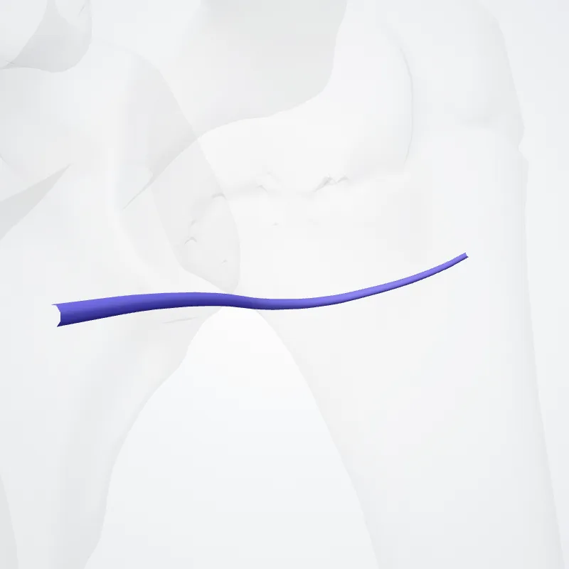 Posterior circumflex humeral vein (Vena circumflexa posterior humeri) highlighted in a 3D model of the human body
