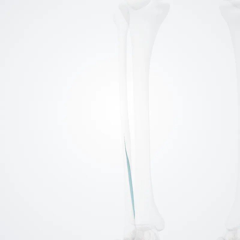 Septum intermusculare posterius cruris (Posterior intermuscular septum of leg) hervorgehoben in einem 3D-Modell des menschlichen Körpers