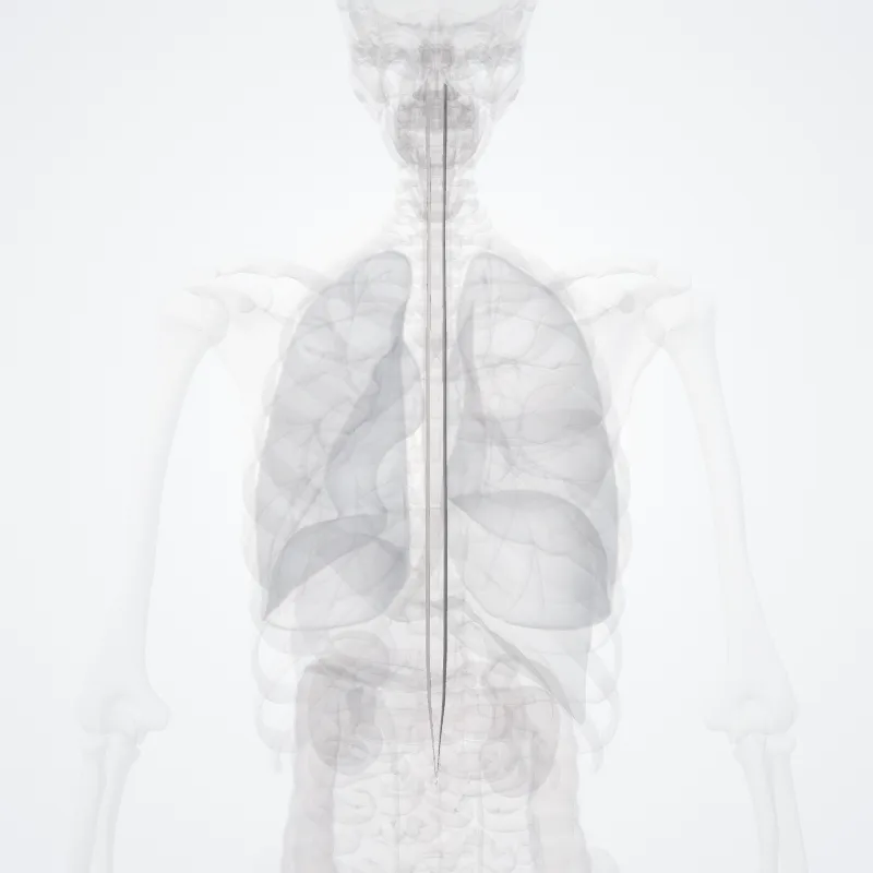 Tractus spinocerebellaris posterior (Posterior spinocerebellar tract) hervorgehoben in einem 3D-Modell des menschlichen Körpers