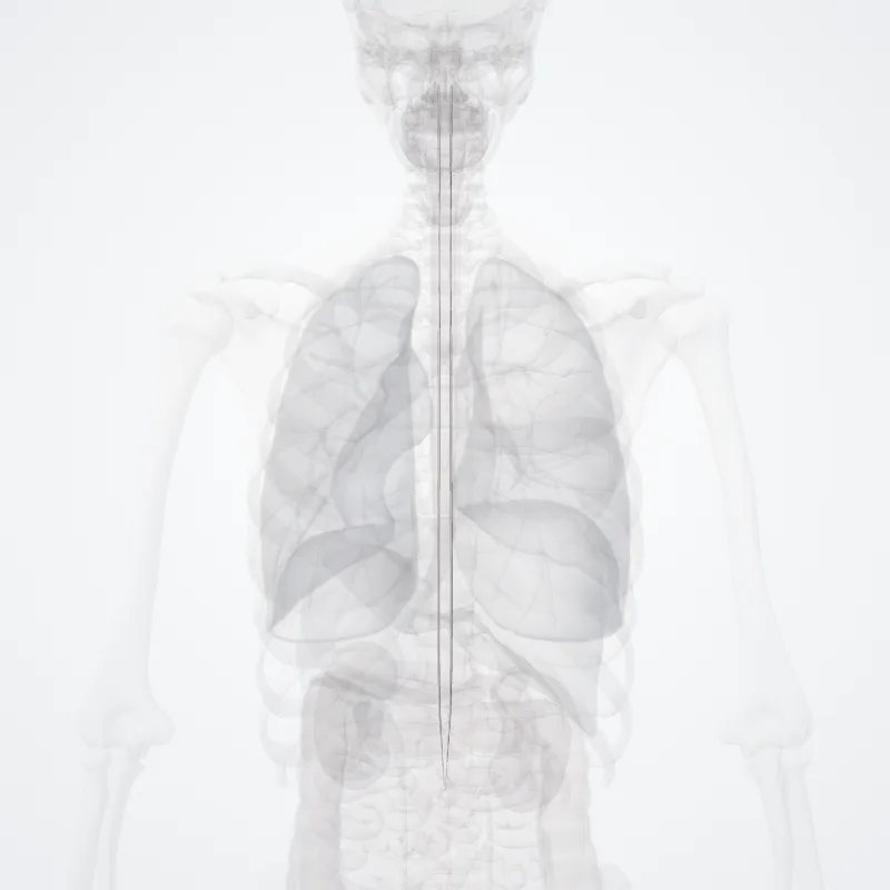 Posterolateral tract (Fasciculus posterolateralis) highlighted in a 3D model of the human body