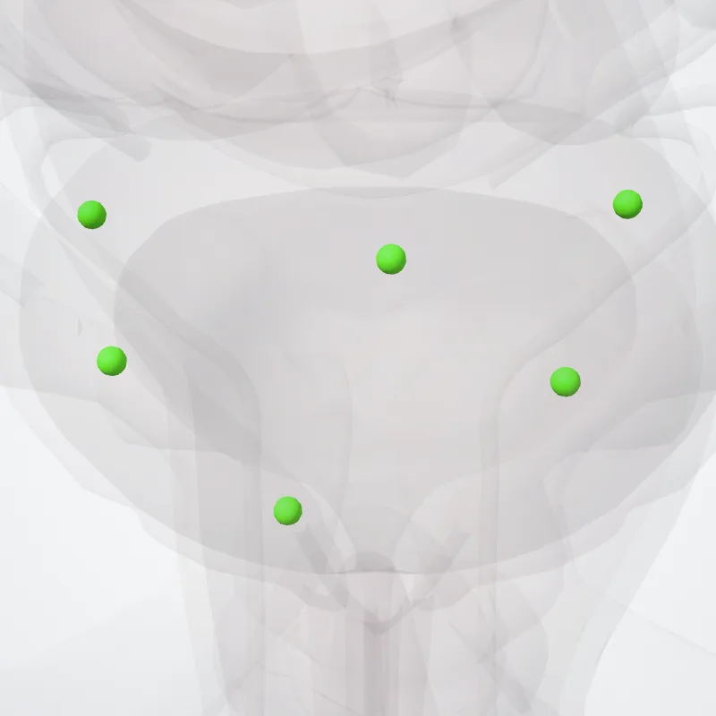 Nodi postvesicales (Postvesical nodes) hervorgehoben in einem 3D-Modell des menschlichen Körpers