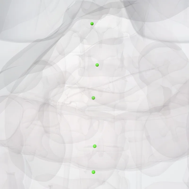 Pre-aortic nodes (Nodi preaortici) highlighted in a 3D model of the human body