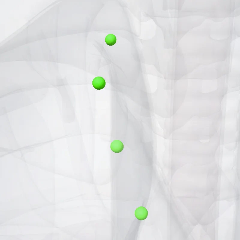 Nodi prepericadiaci (Prepericardial nodes) hervorgehoben in einem 3D-Modell des menschlichen Körpers