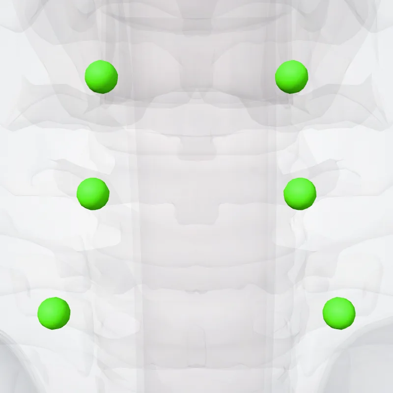 Pretracheal nodes (Nodi pretracheales) highlighted in a 3D model of the human body