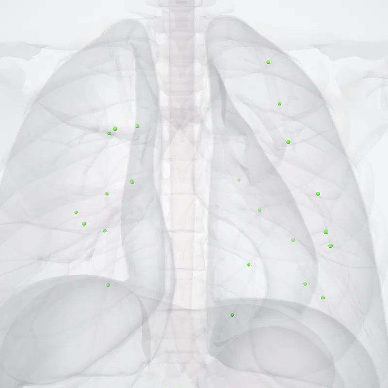 Pulmonary lymph nodes (Nodi lymphoideipulmonales) highlighted in a 3D model of the human body