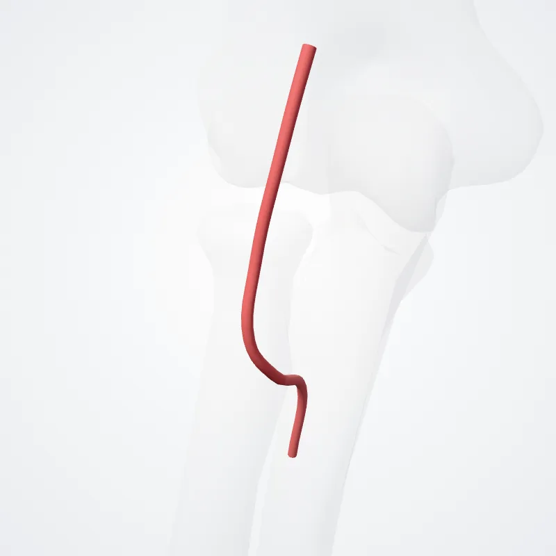 Recurrent interosseous artery (Arteria interossea recurrens) highlighted in a 3D model of the human body