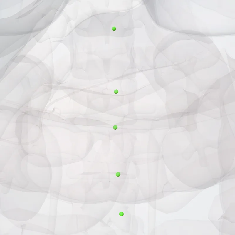 Nodi retroaortici (Retro-aortic nodes) hervorgehoben in einem 3D-Modell des menschlichen Körpers