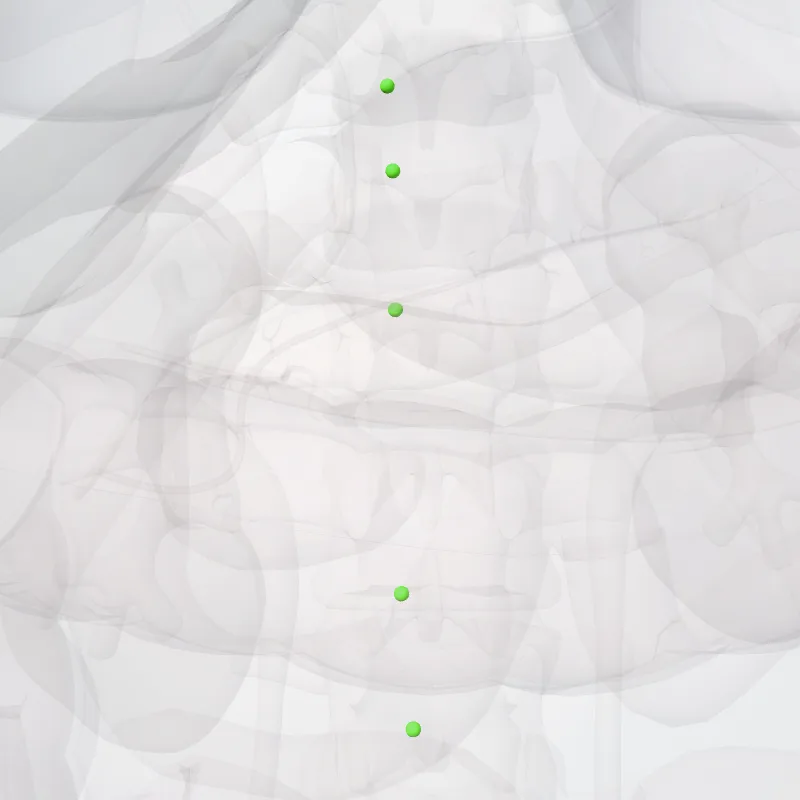 Nodi retrocavales (Retrocaval nodes) hervorgehoben in einem 3D-Modell des menschlichen Körpers