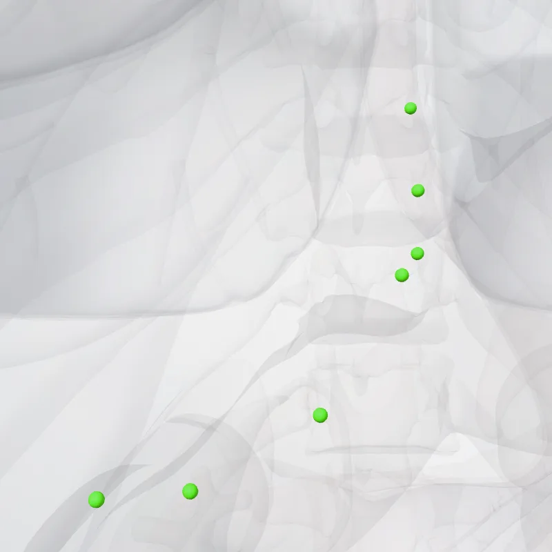 Nodi gastroomentales dextri (Right gastro-omental nodes) hervorgehoben in einem 3D-Modell des menschlichen Körpers