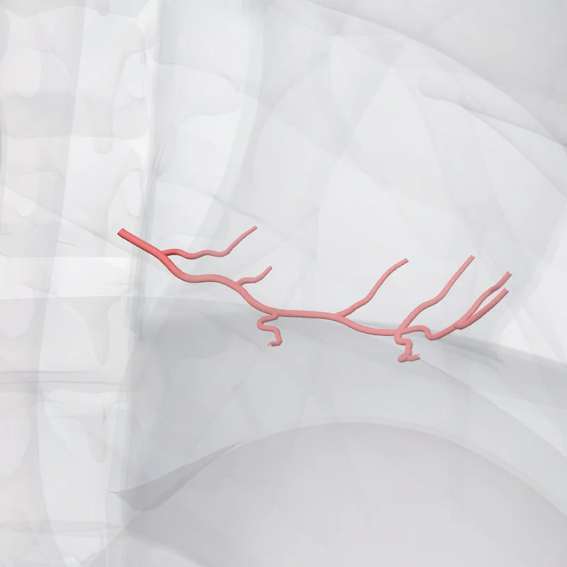 (Ramus inferolateralis dexter arteriae coronariae dextrae) (Right inferolateral branch of right coronary artery) hervorgehoben in einem 3D-Modell des menschlichen Körpers