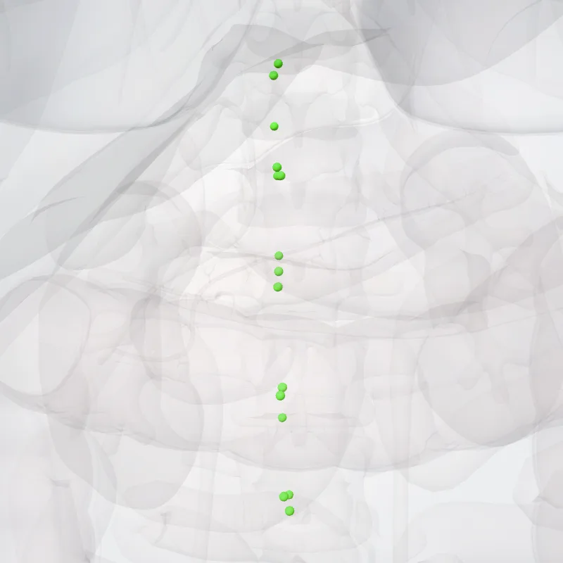 Nodi lumbales dextri (Right lumbar nodes) hervorgehoben in einem 3D-Modell des menschlichen Körpers
