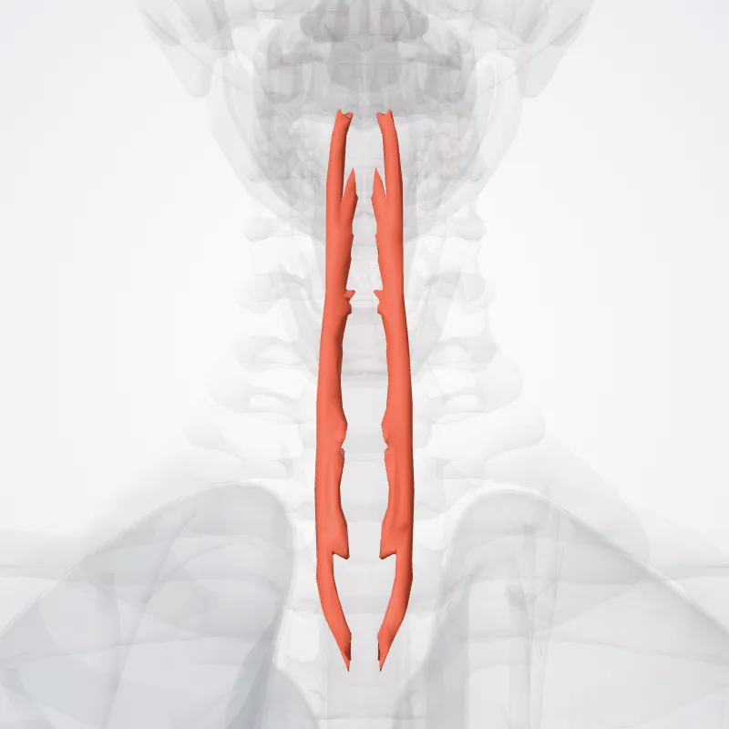 Musculus spinalis colli (Spinalis colli muscle) hervorgehoben in einem 3D-Modell des menschlichen Körpers