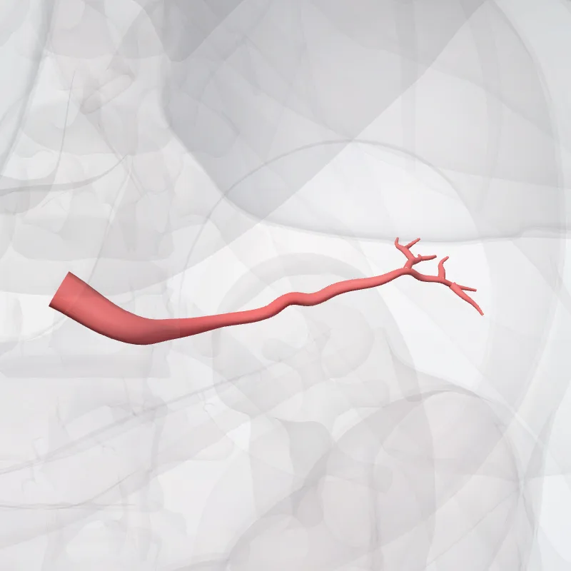 Arteria splenica (Splenic artery) hervorgehoben in einem 3D-Modell des menschlichen Körpers