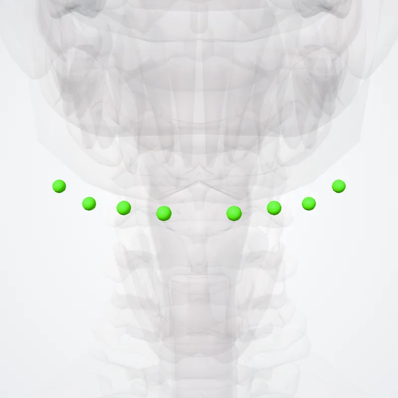 Submental nodes (Nodi submentales) highlighted in a 3D model of the human body