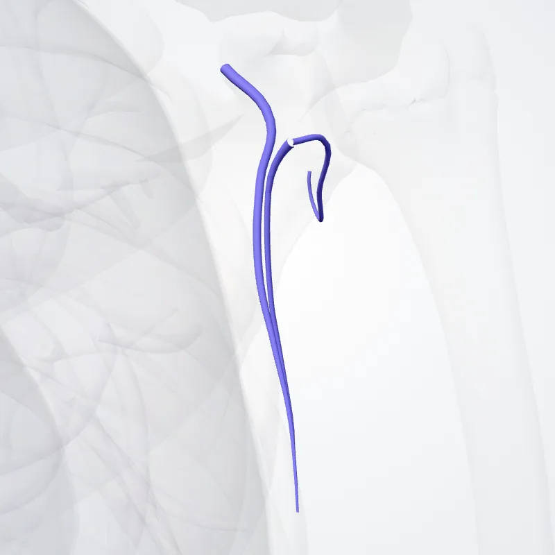 Subscapular vein (Vena subscapularis) highlighted in a 3D model of the human body