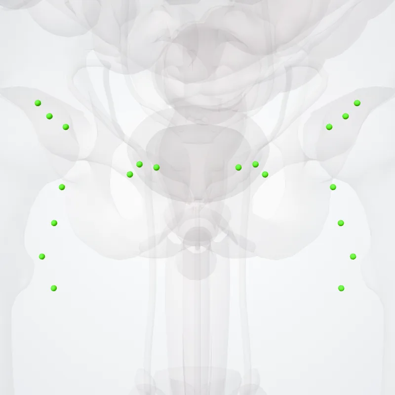 Nodi inguinales superfciales (Superficial inguinal nodes) hervorgehoben in einem 3D-Modell des menschlichen Körpers