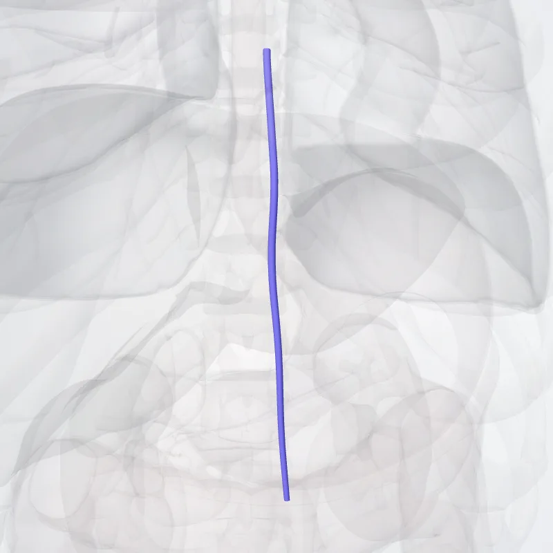 Superior epigastric veins (Venae epigastricae superiores) highlighted in a 3D model of the human body