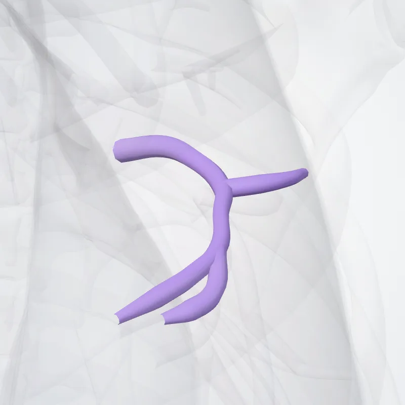 Arteria lingularis superior pulmonis sinistri (Superior lingular artery of left lung) hervorgehoben in einem 3D-Modell des menschlichen Körpers