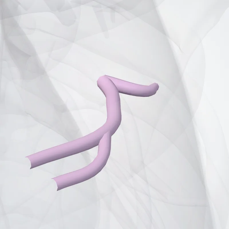 Superior lingular segmental bronchus of left lung (BIV) (Bronchus segm. lingularis sup. pulmonis sinistri (BIV)) highlighted in a 3D model of the human body