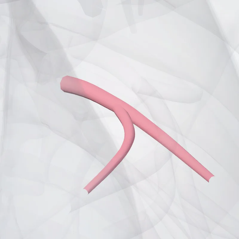 Superior lingular vein of left lung (Vena lingularis superior pulmonis sinistri) highlighted in a 3D model of the human body