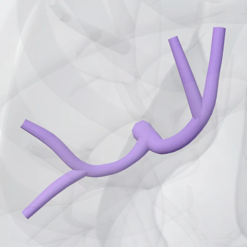 Arteria segmentalis superior pulmonis sinistri (Superior segmental artery of left lung) hervorgehoben in einem 3D-Modell des menschlichen Körpers