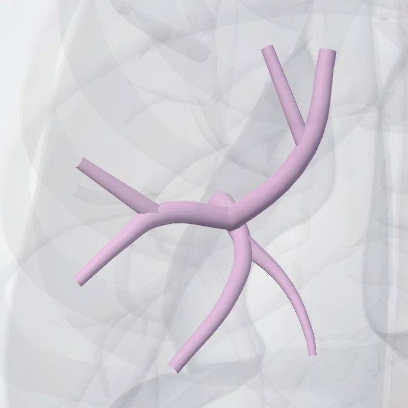 Bronchus segmentalis superior pulmonis sinistri(bvi) (Superior segmental bronchus of left lung (BVI)) hervorgehoben in einem 3D-Modell des menschlichen Körpers