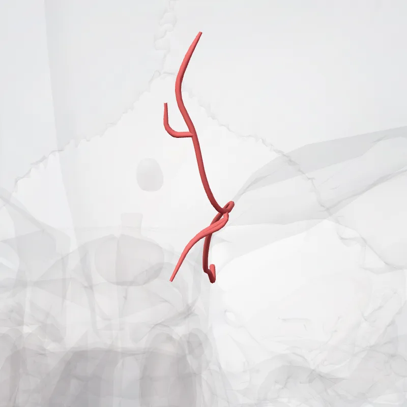 Supratrochlear artery (Arteria supratrochlearis) highlighted in a 3D model of the human body
