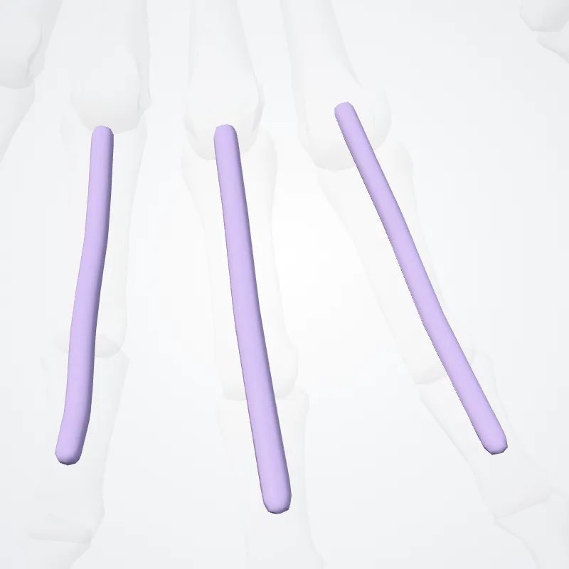 Synovial sheaths of digits of hand (Vaginae synoviales digitorum) highlighted in a 3D model of the human body