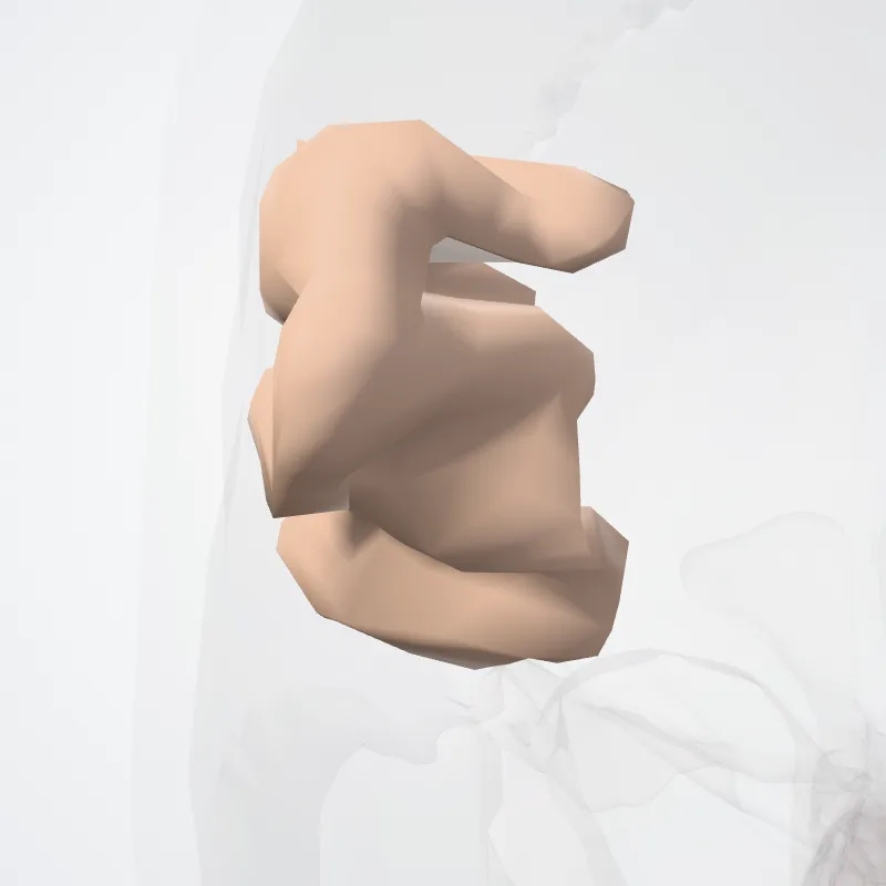 Planum temporale (Temporal plane) hervorgehoben in einem 3D-Modell des menschlichen Körpers
