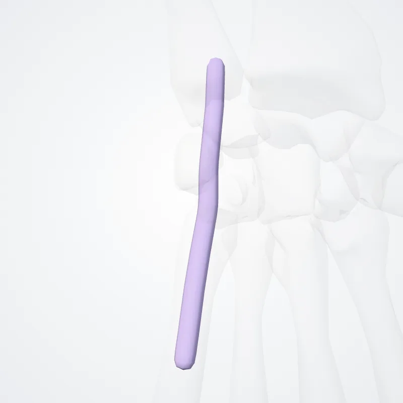 Tendon sheath of extensor digiti minimi manus hervorgehoben in einem 3D-Modell des menschlichen Körpers