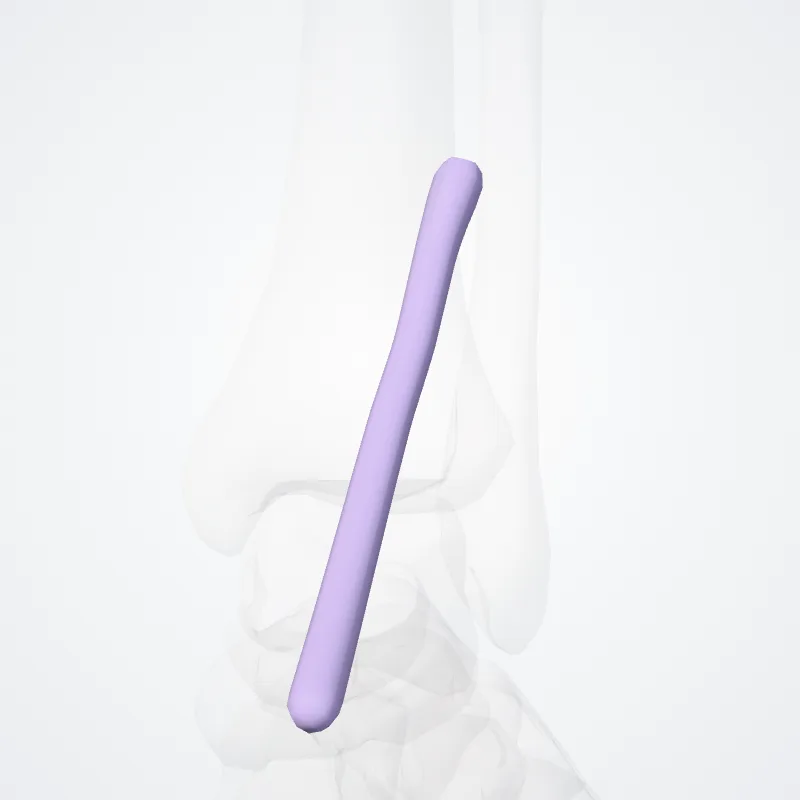 Vagina tendinis extensoris longi hallucis (Tendon sheath of extensor hallucis longus) hervorgehoben in einem 3D-Modell des menschlichen Körpers
